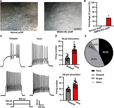 Electrophysiological Properties of Substantia Gelatinosa Neurons in the Preparation of a Slice of Middle-Aged Rat Spinal Cord